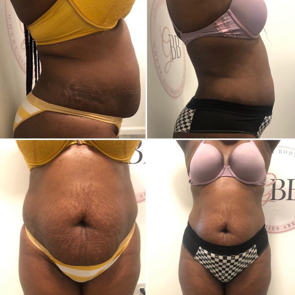 110719363_779001139506700_7689292520698098830_n