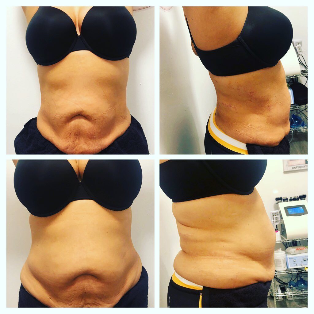 83124171_612696905955793_6287260604948988351_n